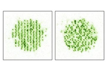 Superlattices under the microscope